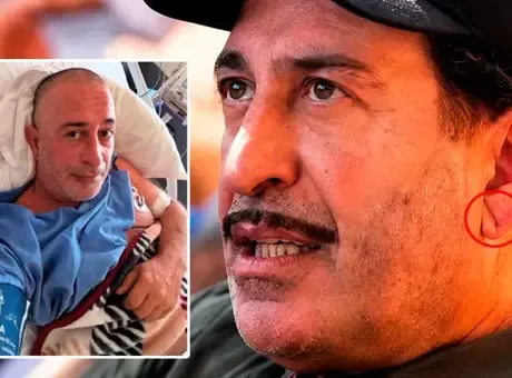 Cem Yılmaz'ın kulağındaki kalp krizi detayı! Doktor çizgiyi gösterdi: 'Yıllardır var'