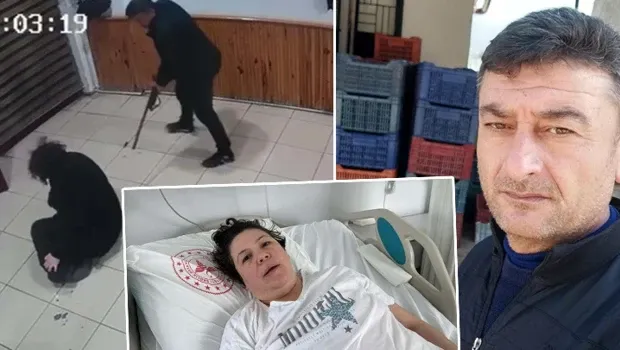 Boşanma aşamasındaki eşi tarafından vuruldu, bacakları ampute edildi! 'Pes' dedirten savunma: Sevdiğ