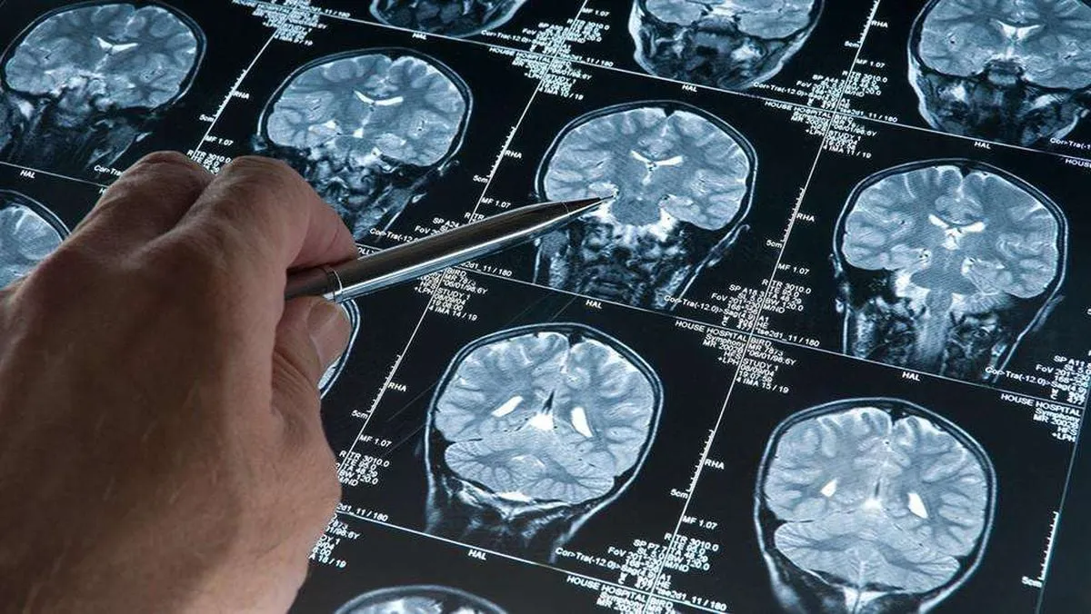 Derin Uyku Beyin Dalgaları Alzheimer'a Karşı Koruma Sağlayabilir