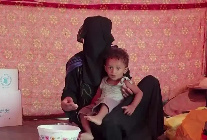 UNICEF'TEN Yemen için kritik uyarı! 2,2 milyon çocuk akut beslenme yetersizliği yaşıyor