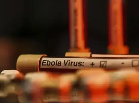 Nijerya'da ilk Ebola virüsü vakası tespit edildi